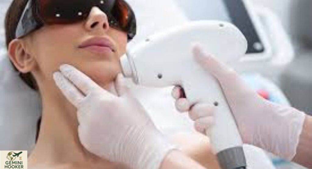 Laser hair removal in Nottingham—Everything you should know